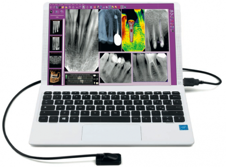 Визиограф MyRay ZEN-X, размер датчика 1